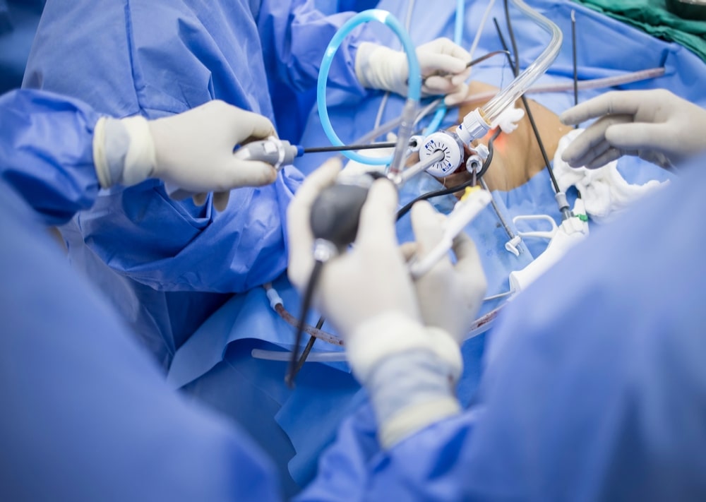 Advanced Endoscopic Procedures